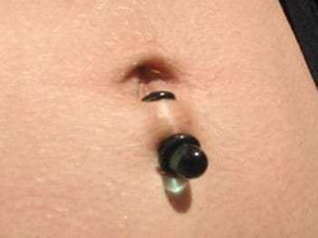 Belly Button Ring Rejection Pictures Belly Button Ring Rejection Pictures