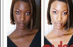 Glutathione Skin whitening – Pills, Supplements, Injection, Soap