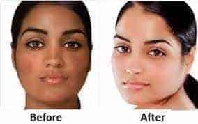 How to Lighten Skin â€