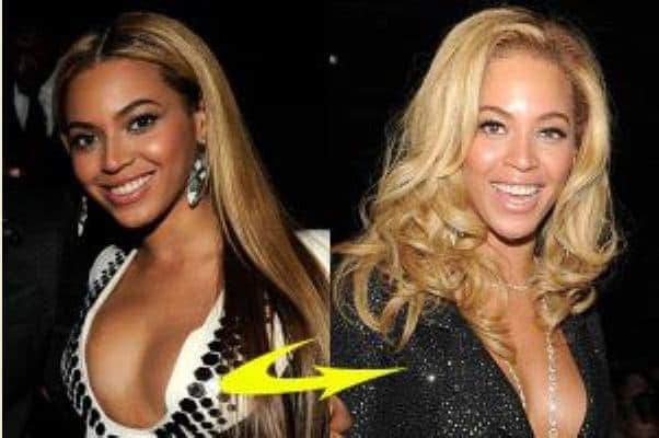 beyonce skin bleaching