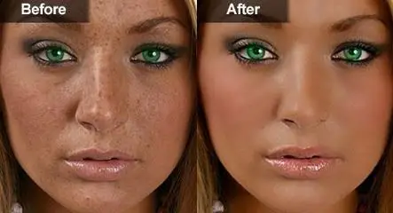  Skin Best skin lightening cream for african americans- whitening