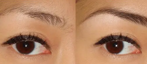 40+ Castor Oil Eyebrow Growth
 Background