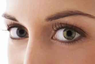 color eye change laser surgery cost permanent much beautyclue does