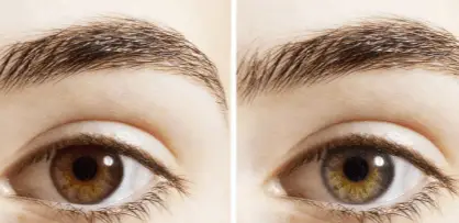Reasons why my eye color change