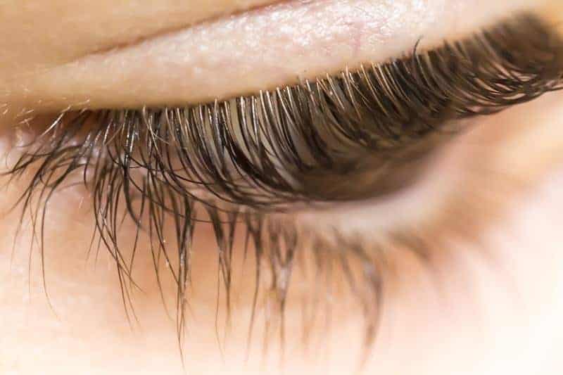 Woman who goes to hospital with itchy eyes has lash MITES ...