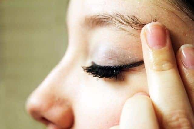 Ingrown Eyebrow Hair Cyst Infected How To Treat Pluck Bump