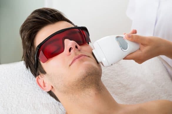 Electrolysis Hair Removal Best Safe Side Effects And Precautions 