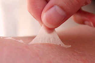 Skin peel as a symptom of sun poisoning