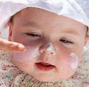 Cure for Baby Acne