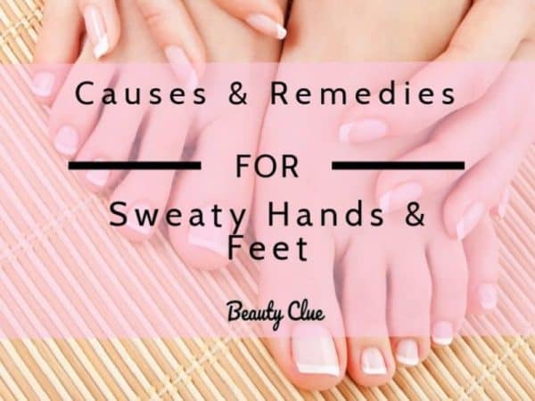 sweaty hands cure