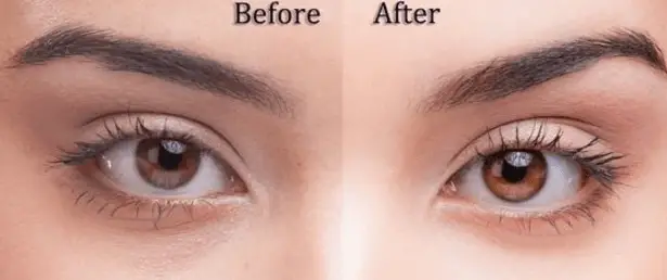eye color change before and after
