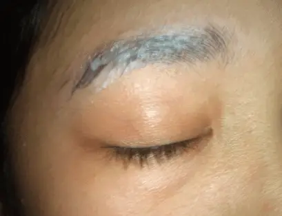 Dandruff in Eyebrows, Dry Skin, Get Rid, Remove, Naturally 